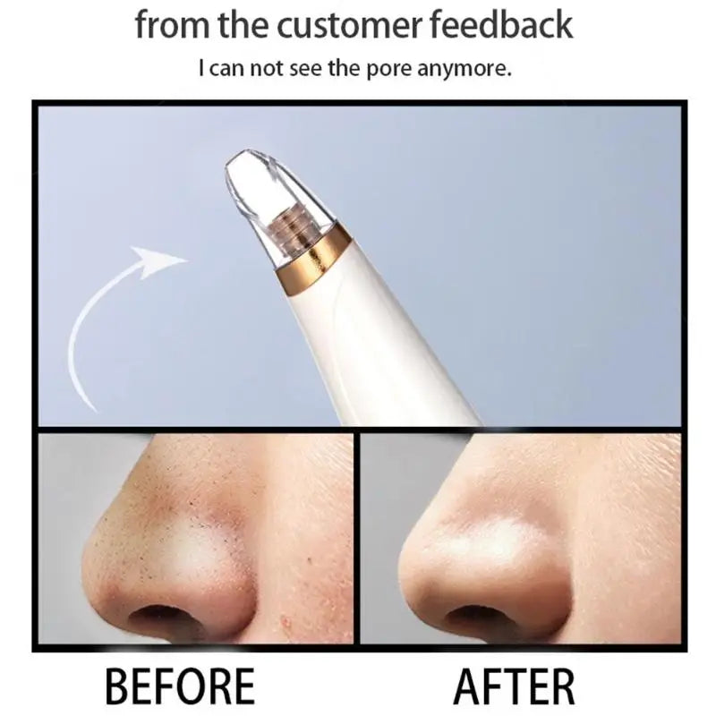 Hyper Suction Device & Limited Edition