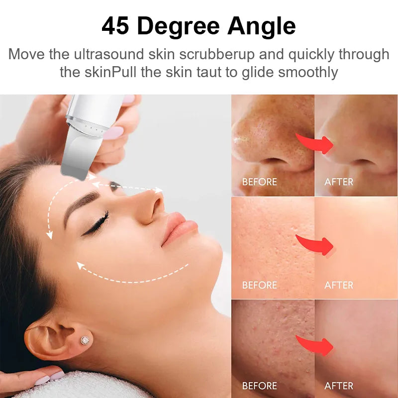 Skin cleaning device