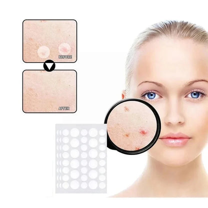 Acne Pro Patches